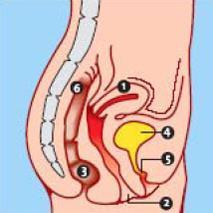 Plaatje vrouw 1. baarmoeder 2. vagina 3. anus 4. blaas 5. plasbuis 6.