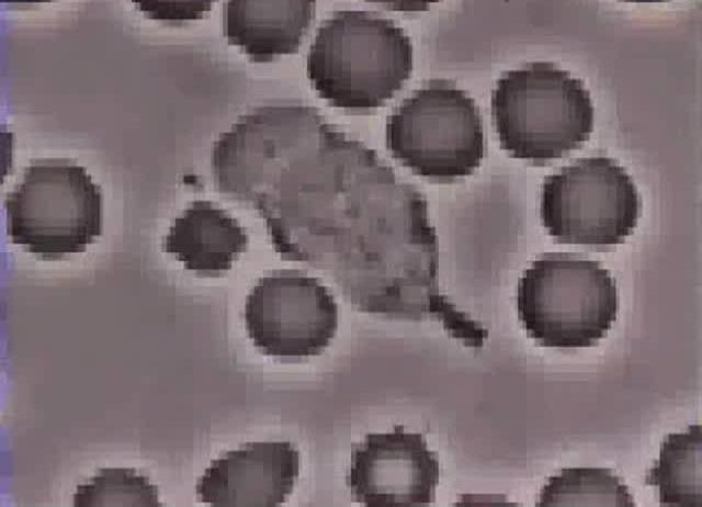 Vastbesloten neutrofiele granulocyt die een
