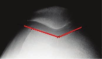 Figuur 6 Axiale opname van de knie.