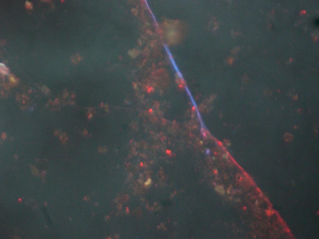 Under epifluorescence (x400): fungal hyphae and bacteria, closely associated with soil particles Fungal hyphae