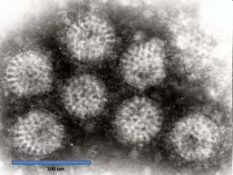 Oorzaken Bacteriën Virussen Parasieten
