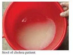 Cholera (krijg de kolere) Toxine