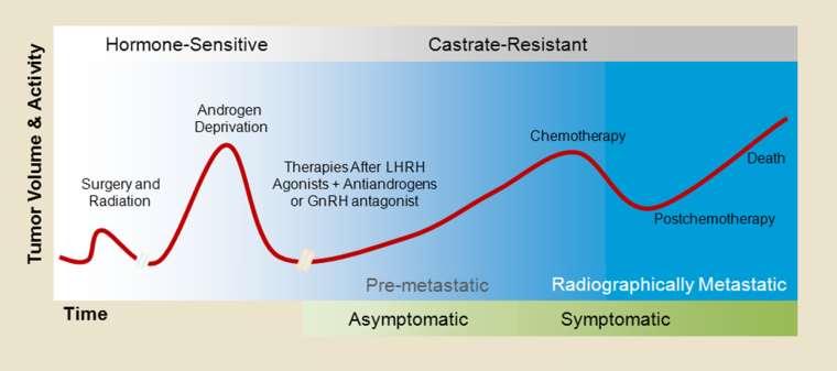 Hormoon Sensitief Prostaat Carcinoom (HSPC) HSPC Subgroepen: Recurrence na eerdere