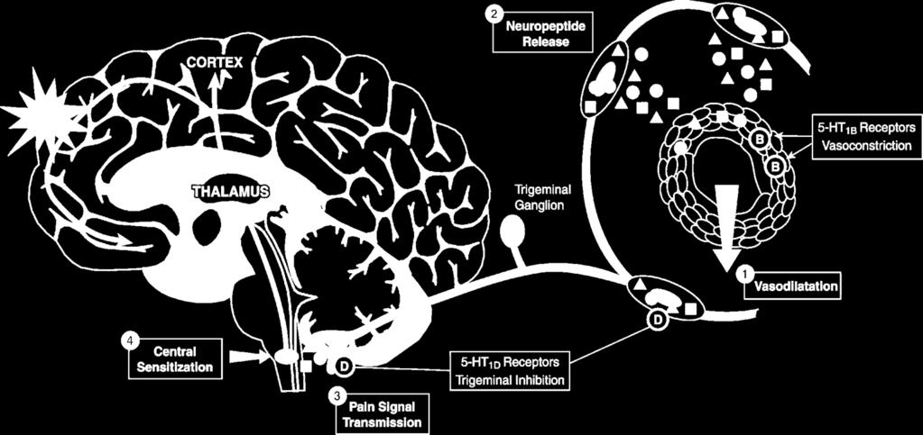 Sensitization Pain Signal Transmission Vasodilatation Acute