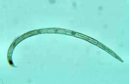 Mycorrhiza (schimmels) spelen rol bij voedselopname door