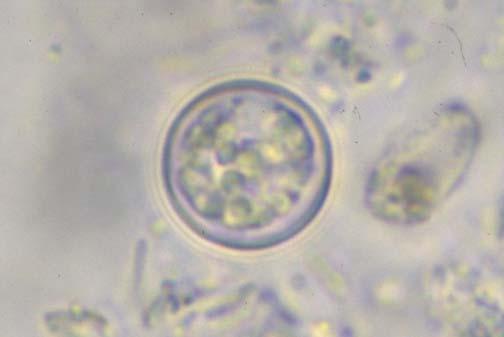 2: Oocyste van Cyclospora cayetanensis 