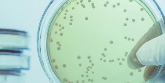 25 Geen hoog kiemgetal, toch kwaliteitsproblemen Een voorbeeld van een bacterie die ook bij niet-verhoogde kiemgetallen problemen in de zuivelverwerking veroorzaakt, is de boterzuurbacterie