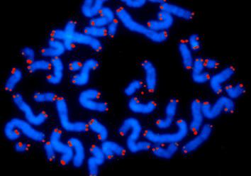 LONGFIBROSE 5 Danazol voor de behandeling van refractaire pulmonale fibrose De behandelopties bij progressieve pulmonale fibrose zijn op dit moment beperkt.