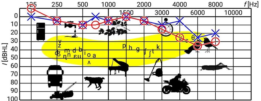 Hieronder zijn de resultaten van linker- en rechteroor weergegeven in één audiogram. Alle klanken die boven de grafiek liggen, kunnen niet waargenomen worden.