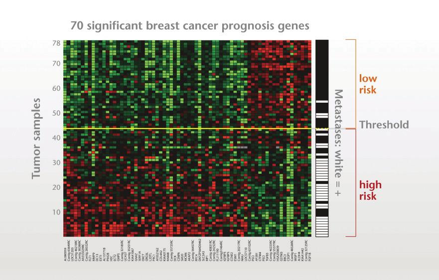 Figure 1. Micro-array technology used for the 70-gene signature The remaining 34 patients developed distant metastases within 5 years after diagnosis and were defined as poor prognosis or high risk.