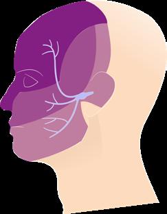 Wanneer kan een behandeling nodig zijn? Trigeminusneuralgie is een heel pijnlijke aandoening waarbij (meestal schietende) pijnen optreden in één of meerdere takken van de aangezichtszenuw.