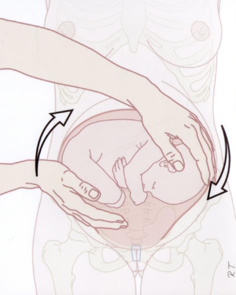 naar de stand van het hoofd van de baby naar de hoeveelheid vruchtwater naar de ligging van de placenta (moederkoek) of er eventuele vleesbomen of andere afwijkingen zijn die de ingang van het bekken