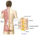10 antwoorden over lage rughernia en beenpijn (lumbosacraal radiculair syndroom) 1. Wat is een hernia? Onze wervelkolom/rug bestaat uit een opeenstapeling van beenderige wervels.