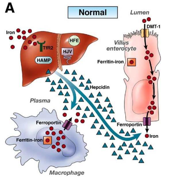 Erfelijke factoren voor hemochromatose: De belangrijkste factoren zijn de C282Y en de H63D mutaties, maar er zijn ondertussen meerdere erfelijke afwijkingen bekend; namelijk Hemochromatose type