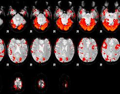 De neuromarketing-techniek fmri leent zich hier uitstekend voor.