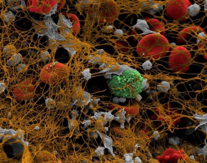 9 1. Adhesion, aggregation of platelets >>>>>> primary hemostasis 2.