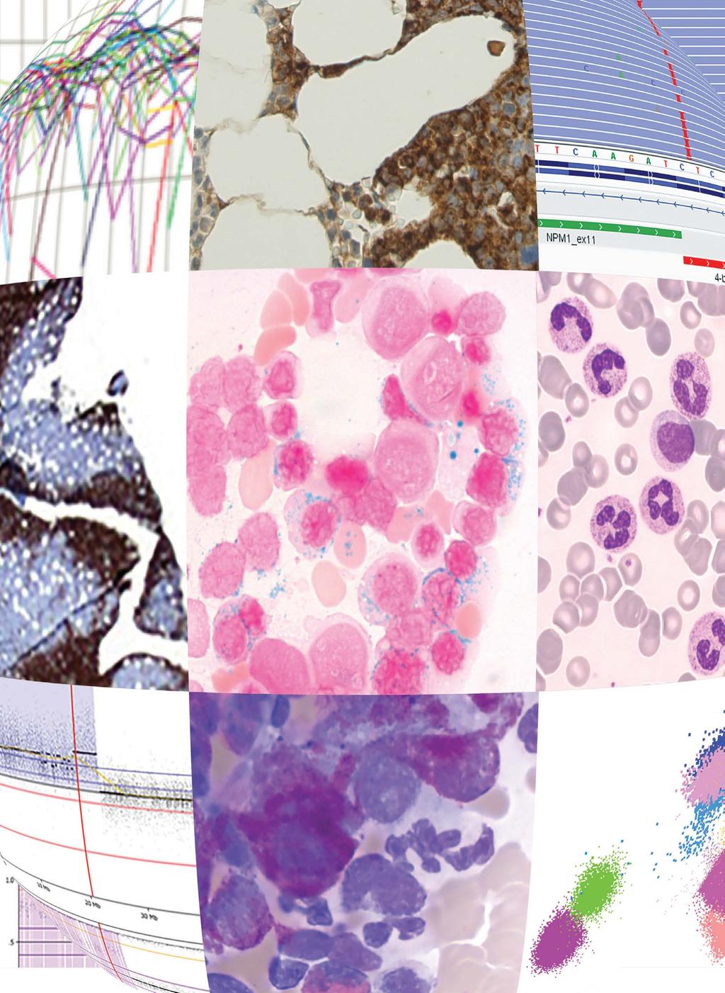 Kanker Instituut Integrale Diagnostiek Hemato-oncologische Laboratoria Erasmus MC