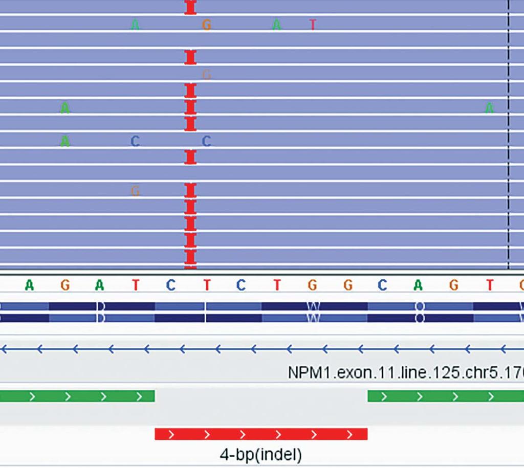 NPM1