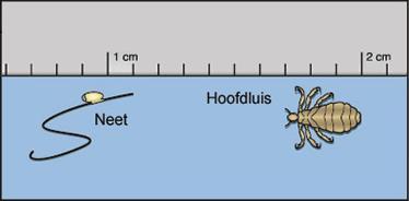 Gewone lichaamshygiëne is niet van invloed op het krijgen van hoofdluis. Luizen leven van mensenbloed en dat vinden ze ook op een schoon, kortgeknipt hoofd. 1.5 Is het erg om hoofdluis te hebben?