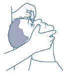 PATIËNTENINFORMATIE 2. Laat de patiënt een gootje maken door met de wijsvinger het onderste ooglid naar beneden te trekken. Eventueel kunt u dit doen met de duim van uw andere hand.