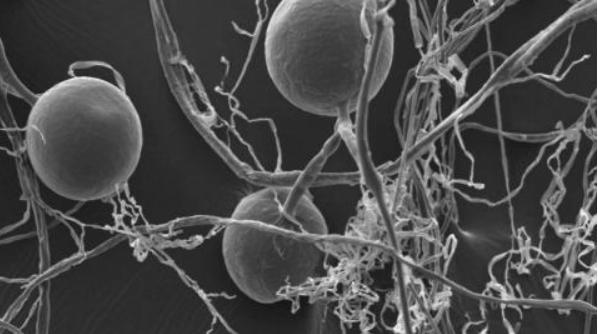 Arbusculaire mycorrhiza (AM) Vernoemd naar arbuscules = miniatuur boompjes tussen wortelcellen (opslag- en overlevingsorgaantjes) Ze vormen lange draden die zich ondergronds verspreiden in