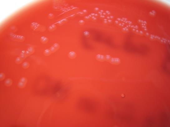 Rapporteren Streptococcus agalactiae: Overrulen van Stap