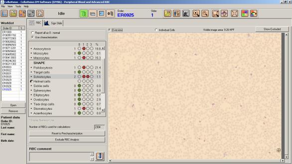 POST-reclassification: 100 80 60 40 20 Cella POST Sensitivity: 100,0 Specificity: 94,8 Criterion : >6 0 0 20 40