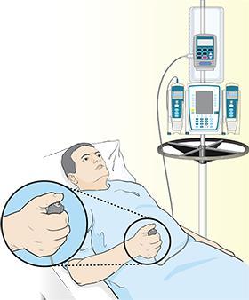 Alternatieven Voor de pijnstilling na een operatie zijn vaak verschillende technieken mogelijk. Sowieso krijgt elke patiënt via het infuus of via pilletjes een combinatie van pijnstillers.