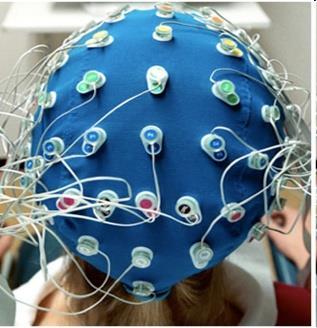 aanvalstype EEG patronen