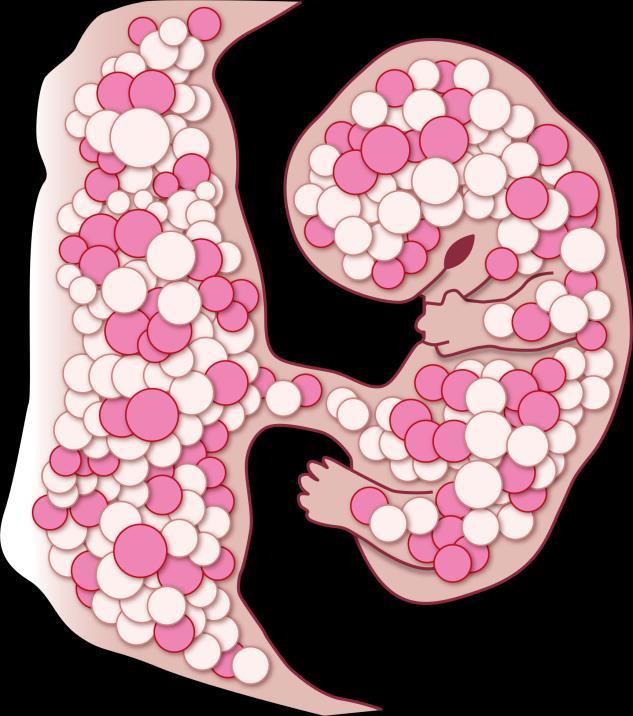 NIPT: nevenbevinding in placenta en kind Diploid