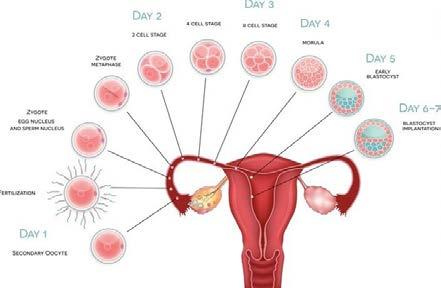 Embryocultuur Dag 3 (8-cel) versus dag 5 (blastocyst) cultuur.
