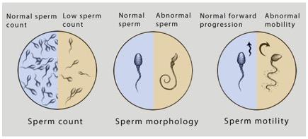 Oorzaken van subfertiliteit Semenanalyse WHO-referentiewaarden = 5 e percentiel, 1900 fertiele mannen Parameter Referentiewaarde 95% CI Volume 1,5 ml 1,4 1,7 Concentratie 15 miljoen