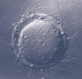 IVF-BEHANDELING IVF-BEHANDELING IVF-PROCEDURE De eicellen worden met hun cumulus in aparte druppels in een kweekmedium gebracht. Daarna worden de zaadcellen bij de eicellen gebracht.