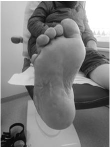 voetinspectie en dragen van aangepast schoeisel -regelmatige opvolging bij