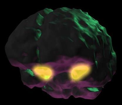 Amygdala Twee amandelvormige neurale clusters Koppelt zintuiglijke waarnemingen aan emoties Bij apen en ratten: zonder amygdala, geen angst Bij stimuleren amygdala: angst en klaar voor de aanval