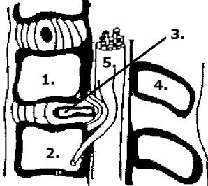 Hernia Tussen de wervels bevindt zich de tussenwervelschijf. Deze is opgebouwd uit een kraakbenige omhulling (anulus), met daarin een geleiachtige, elastische kern (nucleus pulposis).