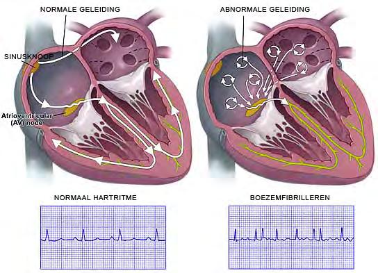 Het hartritme komt overeen met het aantal keren waarmee de grote kamers van het hart per minuut samentrekken. U kunt uw hartritme eenvoudig meten door het nemen van uw polsslag ( zie verder).
