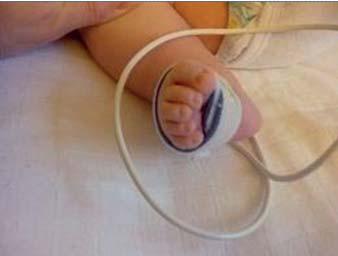 Elektrode Monitor Een saturatiemeter Om te weten of uw kindje voldoende zuurstof in het bloed opneemt, wordt er een saturatiemeter aangesloten door middel van een bandje om de voet of hand/pols.