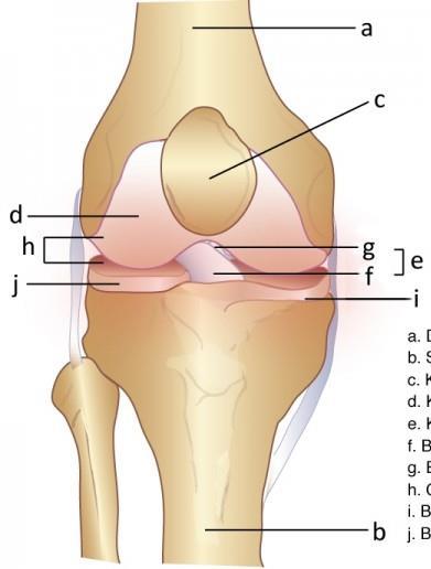 Advies van de orthopedisch chirurg Een van onze orthopedisch chirurgen heeft naar aanleiding van het consult dat hij met u had, voorgesteld uw kniegewricht te vervangen door een totale knieprothese.