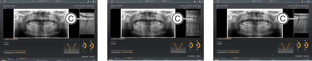 3 Panoramaeditor bedienen Sirona Dental Systems GmbH 3.