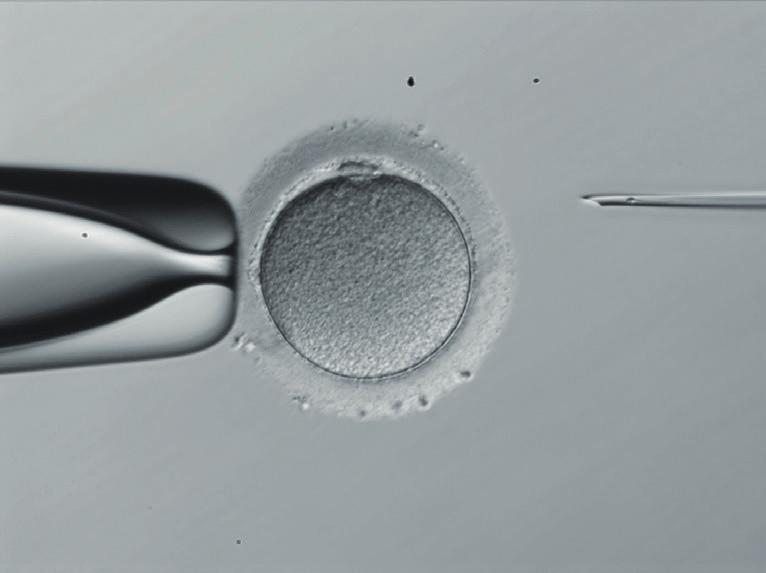 Bevruchte eicellen worden in het fertiliteitslabo in kweek gehouden, opgevolgd en