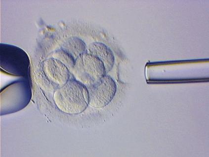 Embryobiopsie op dag 3 na de bevruchting: Bij een 6 tot 10-cellig embryo wordt er eerst met behulp van een laser een opening gemaakt in de mantel die zich rond het embryo bevindt.