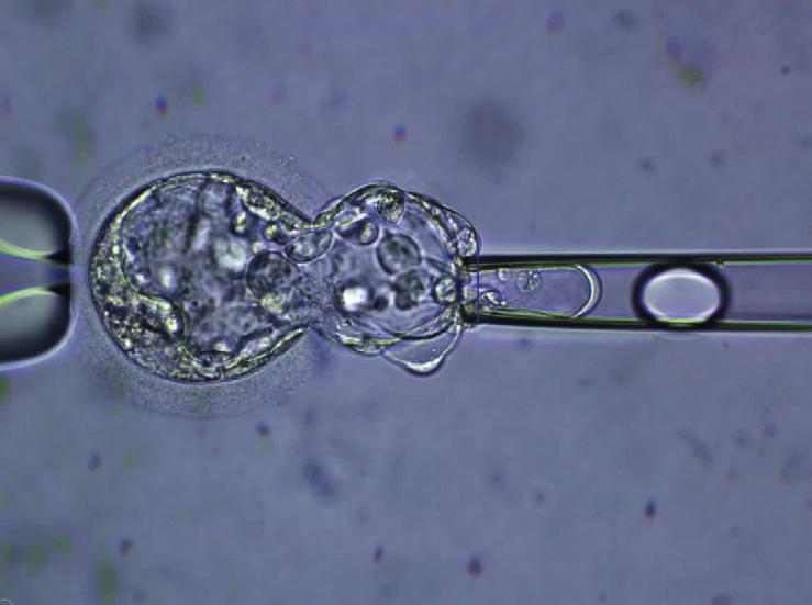 Trofectodermbiopsie op dag 5 of dag 6 na de bevruchting: Op dag 5 of dag 6 na de bevruchting heeft het embryo zich normaal verder ontwikkeld tot een blastocyst.