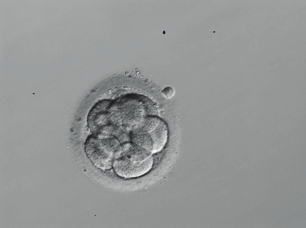 (eicelaspiratie) en in het fertiliteitslabo bevrucht met zaadcellen. Na de bevruchting worden de embryo s in de daaropvolgende dagen beoordeeld op kwaliteit en groei.