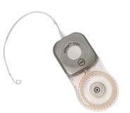 Hoe werkt een cochleair implantaat Het cochleair implantaatsysteem Gehoorverlies wordt vaak veroorzaakt door een beschadiging in een gedeelte van het 3 binnenoor, ook wel de cochlea genoemd, waar
