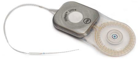 Sterke schokbestendigheid De cochleaire implantaten HiRes Ultra en HiRes 90K Advantage zijn ontwikkeld om de normen voor schokbestendigheid in de branche te overstijgen.