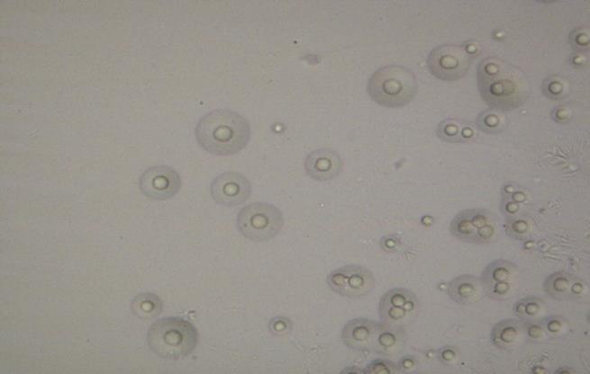 Mycoplasma bovis