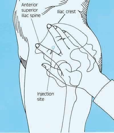 Bilspier Er kan aan de rugzijde (dorsogluteaal) of de buikzijde (ventrogluteaal) van de bilspier (musculus gluteus) geïnjecteerd worden.