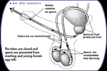 ANATOMISCH VERLOOP VAN EJACULATIE Zaadcellen worden continu aangemaakt ter hoogte van beide testikels en getransporteerd via de zaadleiders (vas deferens) naar de zaadblazen, achter de prostaat.