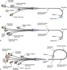 Arteria pulmonalis druk Swan Ganz katheter Arteria pulmonalis druk Swan Ganz katheter Bedside
